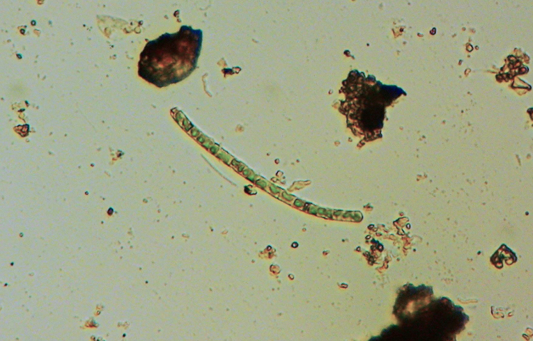 Cylindrocapsa (possibly)