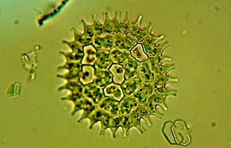 alga - Pediastrum