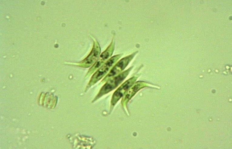 alga - Scenedesmus
