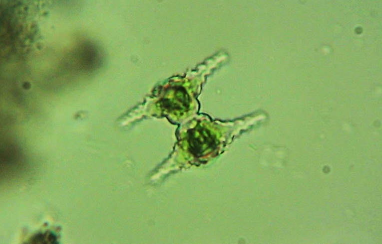 alga - Staurastrum (natator?)