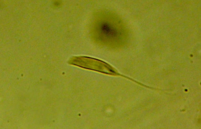 Euglena sp.