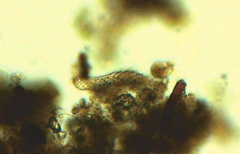 Gastrotriche - poss. Chaetonotus