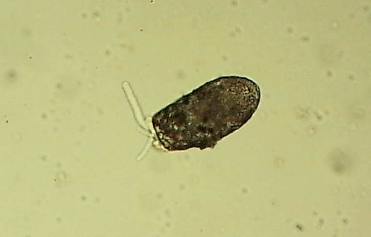 Testate Amoeba