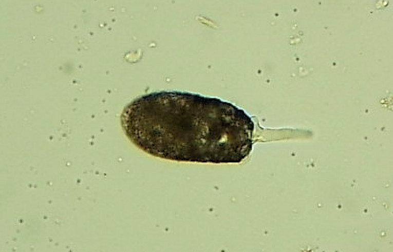 Testate Amoeba
