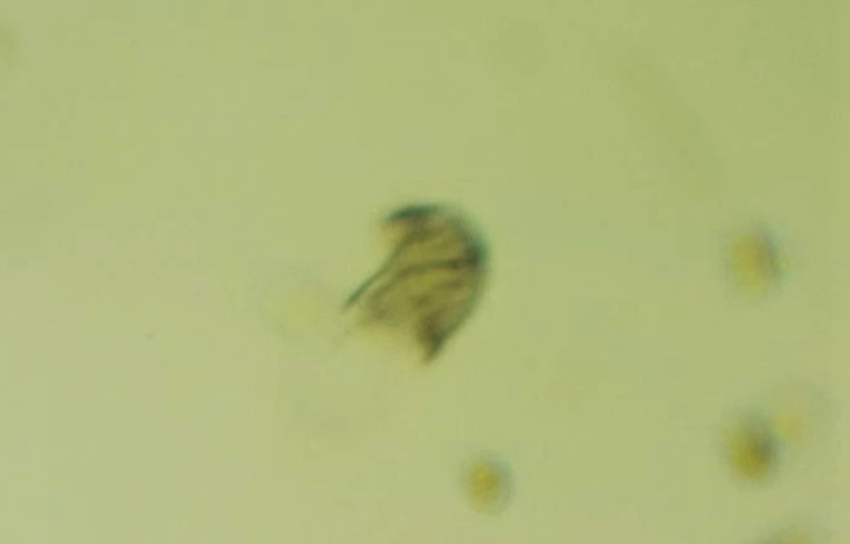Caenomorpha medusula
