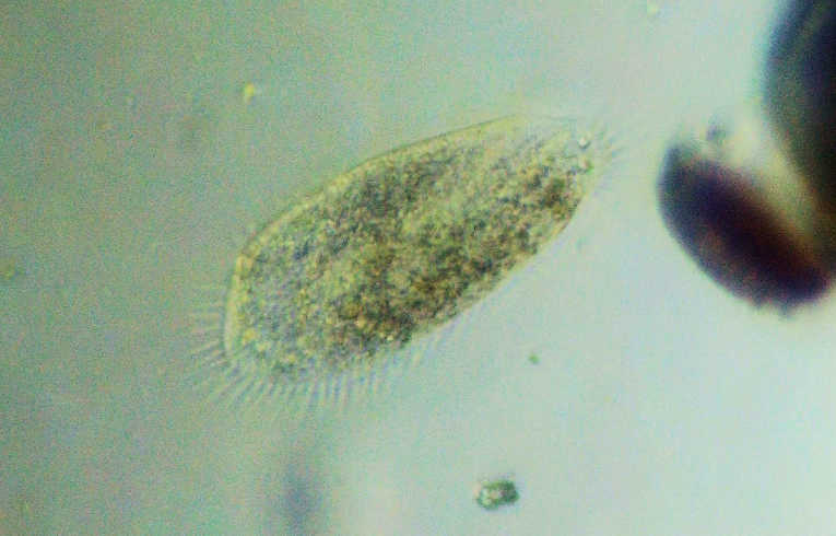ciliate protozoa
