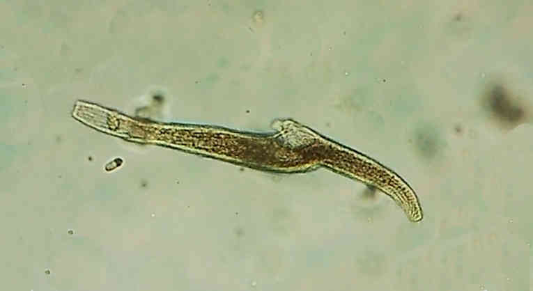 ciliate protozoa - Spirostomum