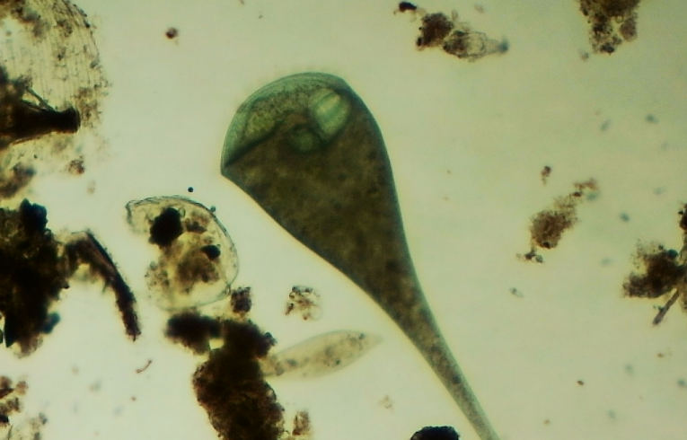 protozoa - Stentor
