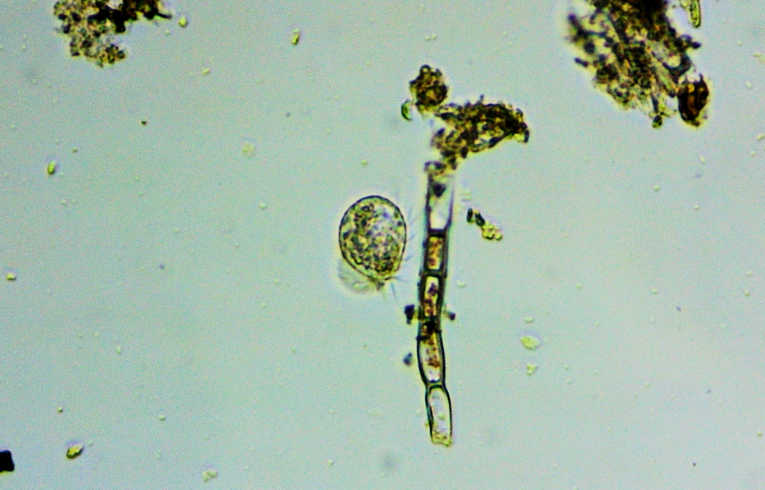 ciliate protozoa