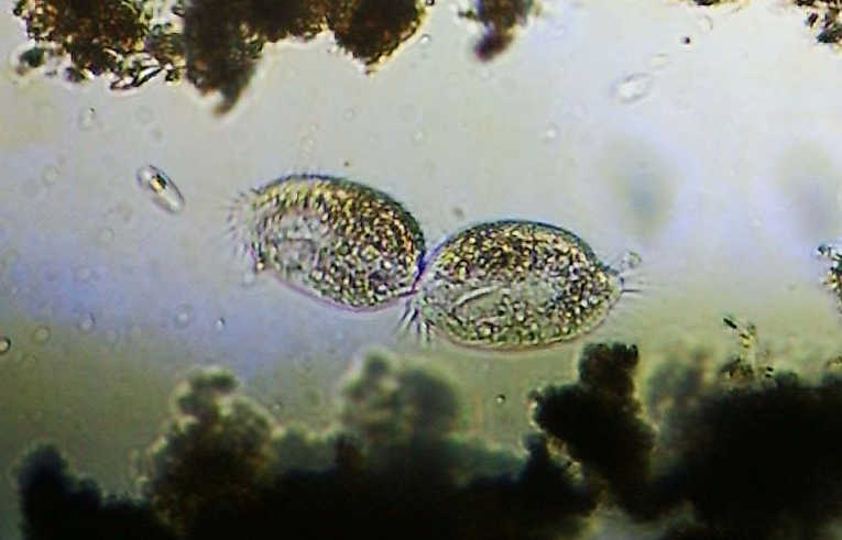ciliate protozoa