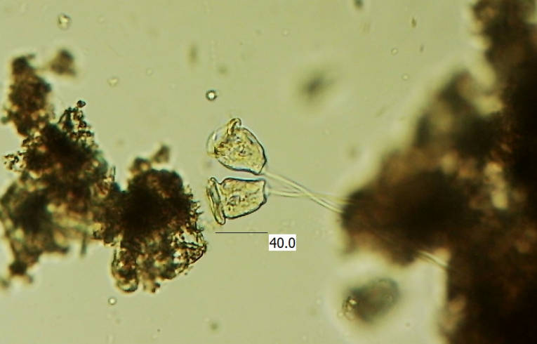 protozoa - Vorticella