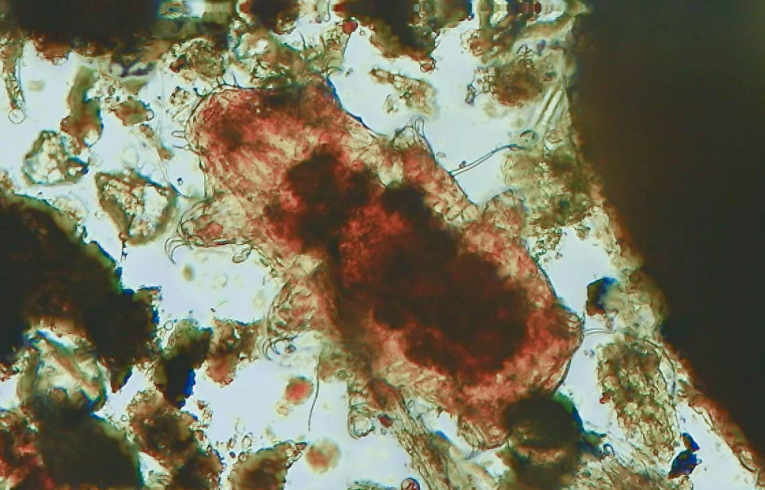 Tardigrade - Macrobiotus sp.